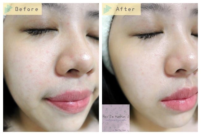 Lancome蘭蔻&hearts;肌因賦活露x小黑瓶