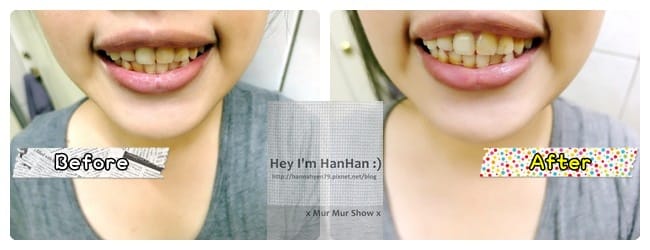 Li-ZEY萊思亮白美齒儀&hearts;美齒儀&hearts;電動牙刷